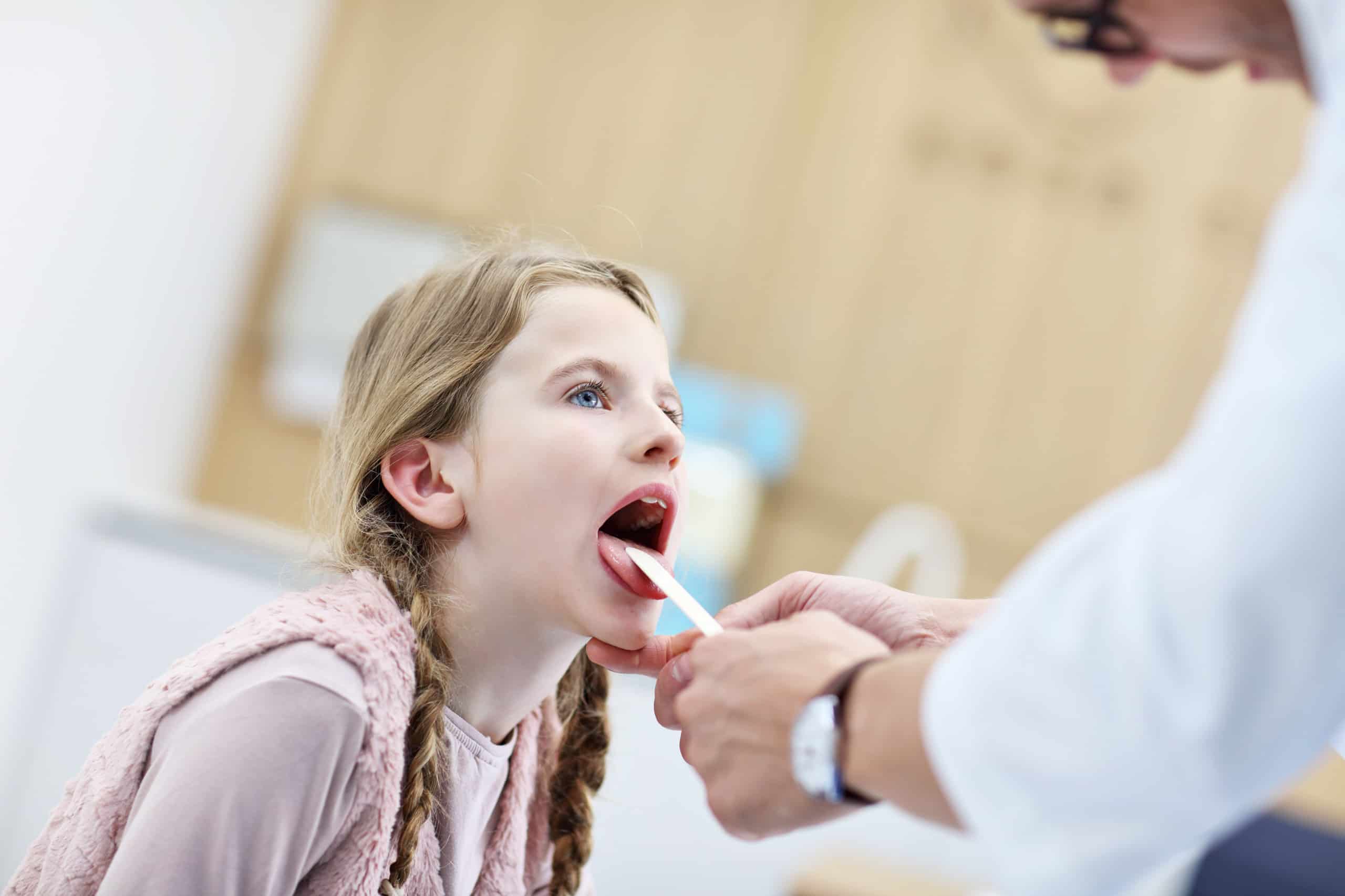 How Doctors Treat Strep Throat